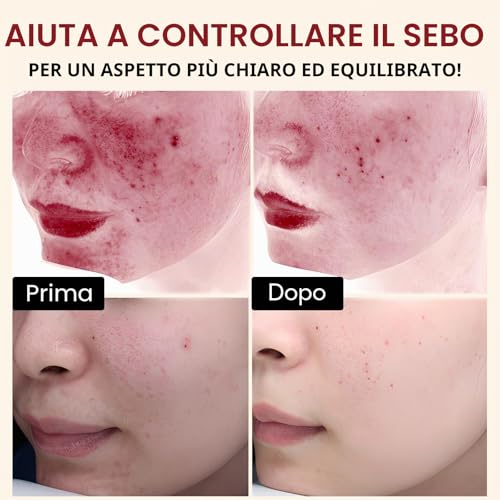 White Rice Gentle Face & Body Exfoliator, Helps Remove Blackheads & Dead Skin, Exfoliation & Hydration, Pore Care, White Rice Glow (100ml)