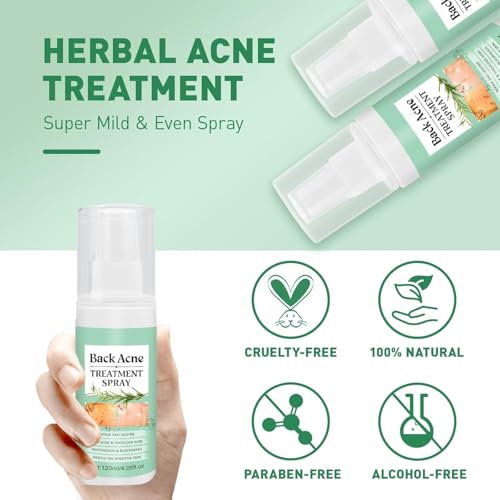 LBOYLOVE® Back Acne Treatment Spray – 2% Salicylic Acid & Hypochlorous Acid Spray for Body Acne, 120ml – Deep Cleansing, Fades Scars, Soothing Repair for Back, Chest & Shoulders
