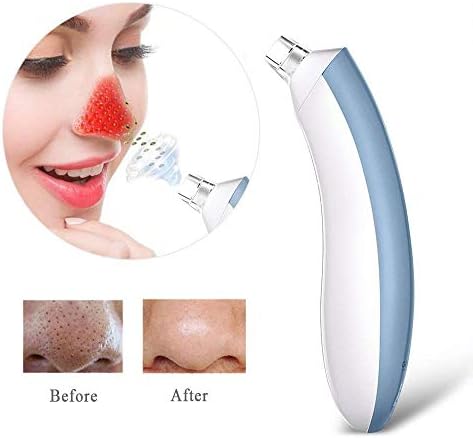 GOODSKY Blackhead Remover Pore Vacuum - Electric Blackhead Removal Suction Tool, Facial Skin Peeling Machine Comedone Extractor Set, USB Rechargeable (Blue)