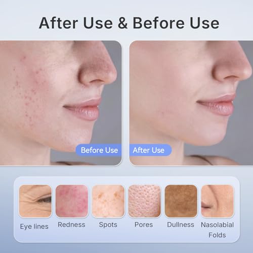 Hello Face Mascarilla LED Facial, Luz roja facial + infrarroja, 280 chips, batería integrada, Terapia de luz LED doméstica