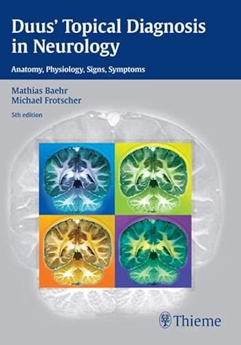 Download Duus' Topical Diagnosis in Neurology: Anatomy, Physiology, Signs, Symptoms PDF