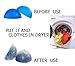 Pet Hair Remover Reusable Lint Removal Fur Catcher Remove Hair from Dogs and Cats for Laundry Dryer, Furniture, Couch, Carpet, Clothing (Blue)
