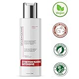 Deux Derme - Stretch Mark Intensive removal Cream With Vitamin E, Shea, Cocoa Butter for Pregnancy, Weight Gain, New Bigger 4 oz.