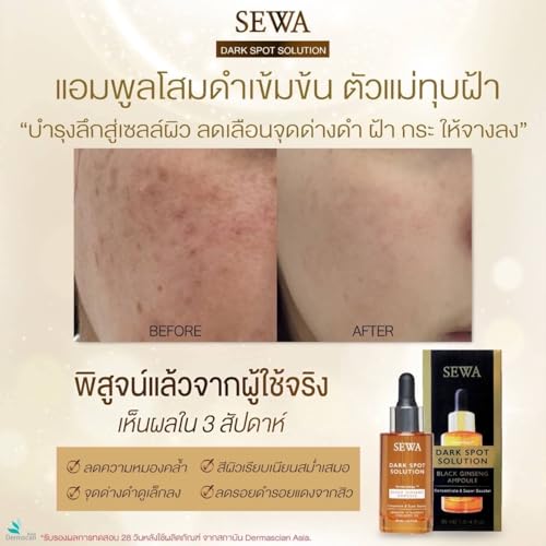 Sewa Dark Spot Solution Black Ginseng Ampoule Concentrate & Super Booster 30ml. Malasma Treatment, 1.01 Fl Oz (Pack of 1), Pack of 1
