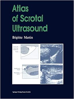 Atlas Of Scrotal Ultrasound 9783642856839 Medicine Health Science Books Amazon Com