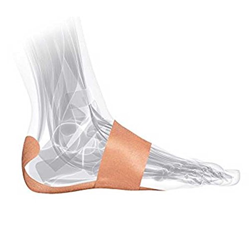 FasciaDerm System for Plantar Fasciitis