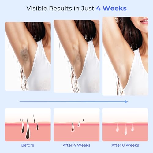 21J IPL Painless Laser Epilator with Cooling Function, Pulsed Light Epilator 9 Energy Levels, Laser Machine Hair Removal Home for Face, Bikini and Body, Dark Blue