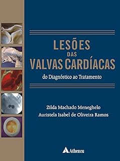 Livro Lesões das Válvulas Cardíacas - Do Diagnóstico ao Tratamento (eBook)