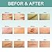 Scar Cream,Scar Removal,Scar Treatment,Scar Removal Cream,Scar Remover Repair Fade Cream for Face Body Surgical Scars Burns Old Scars