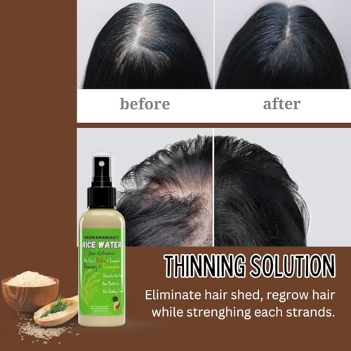 Rice Water For Hair Growth Rosemary Water Spray For Hair Growth