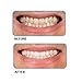 Go Smile Double Action Whitening System 6-day Kit, 12 Count