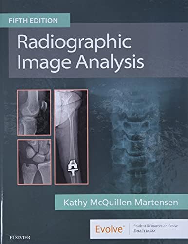Workbook for Radiographic Image Analysis: 9780323544634: Medicine