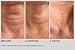 NassifMD Deco-Lift Neck Firming Cream and Tightening Complex Serum, Neck Tightening Cream for Neck Firming, Neck Wrinkle Cream for Saggy Neck, Neck Firming Cream Tightening Sagging Skin
