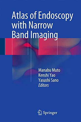 Atlas of Endoscopy with Narrow Band Imaging Atlas of Endoscopy with Narrow Band Imaging