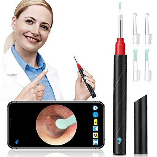Ear Wax Removal Endoscope,Givenxi Wireless Ear Cleaner Tool with 1080P
