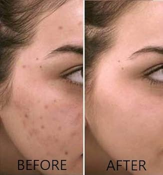 l ascorbic acid face serum