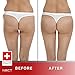 Lower Body Slimming Patch | Ultimate Body Wrap Lipo Applicator | All Natural | Works for Inch Loss Firming Contouring Shaping