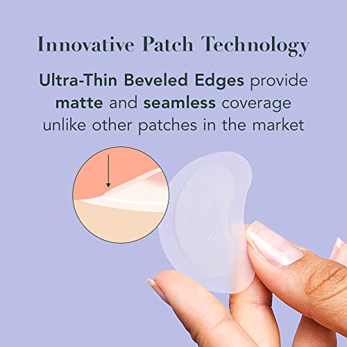 Rael Pimple Patches, Miracle Patches Large Spot Control Cover