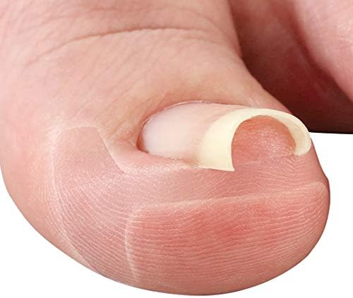 サイプラス 透明巻き爪テープ 特価品コーナー ミエ ヌ 陥入爪 湾曲爪 テーピング 軽度 サイプラス 透明巻き爪テープ 特価品コーナー ミエ ヌ 陥入爪 湾曲爪 テーピング 軽度