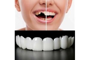 GORM 2 Pairs Fake Teeth Adjustable Veneers Dentures for Men and Women,Cosmetic Tooth Repair Kit for Cover Missing Broken Deformed and Stained Teeth Regain Confident Smile (A)