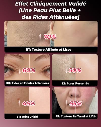 Appareil Visage Radiofréquence Beauté Massage 5-en-1,EMS & Luminothérapie 5 LED,Soins du Visage Professionnels pour le visage et le cou:atténue les rides et ridules,raffermit et lisse la peau(Or Rose)