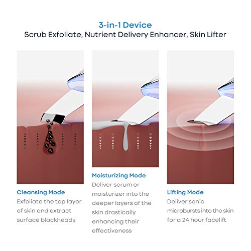 ReNew Skin Scrubber Professional Sonic Facial Exfoliation Device - Oil Dirt Blackhead Remover - Dermabrasion Facial Peel - Clean & Brighten Oily Pores - Blackhead Remover Kit - Skin Tightening