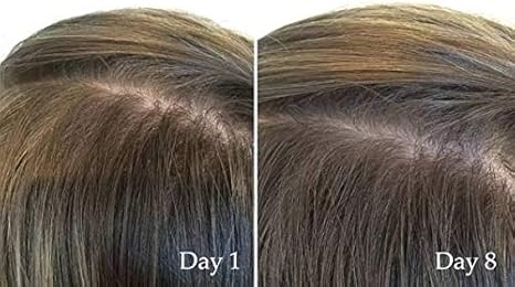 the ordinary canada hair serum