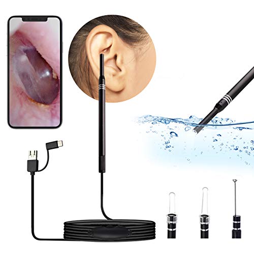 Ear Camera Wax Removal Camera WETDCQ Upgraded HD View Ear Scope
