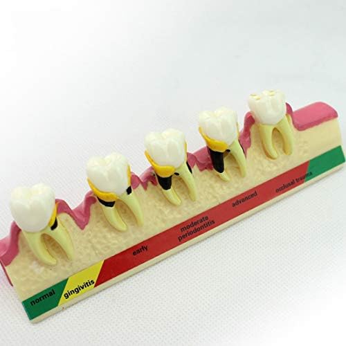 GEEFSU-Teeth Model Oral Periodontology Teaching Resin Material