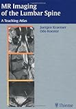MRI of the Lumbar Spine : A Teaching Atlas, Kraemer, Juergen, 3131300914