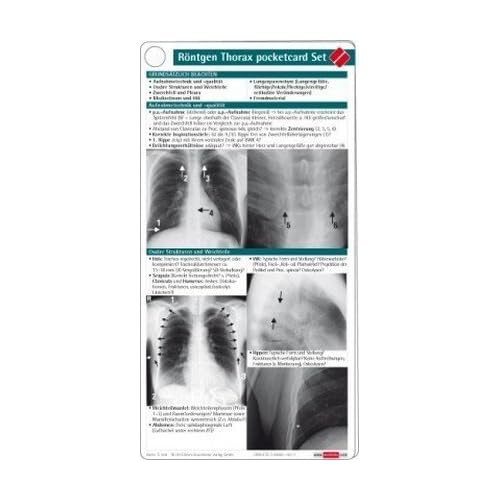  PDF Download R ntgen Thorax Pocketcard Set Kostenlos