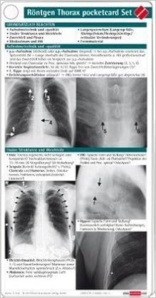 Rontgen Thorax Pocketcard Set Voss S 9783898621823 Amazon Com Books