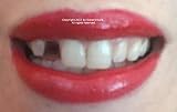 New Temporary Tooth Replacement Mega Kit for 30+ teeth! cosmetic dental fix DVD