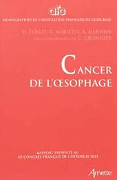 Cancer de l'oesophage