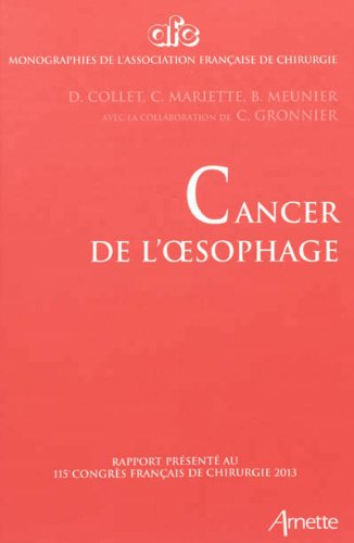 Cancer de l'oesophage