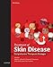 Treatment of Skin Disease E-Book: Comprehensive Therapeutic Strategies