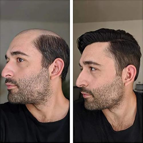 e estelle Men Natural Hair Toupee, Human Hair Q6 Swiss Lace Base PU Around Man Hair Replacement System, For Thin Or Hairloss (Nature Black, 6x8)