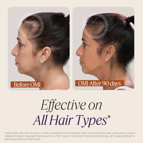 Women's Hair Growth Peptides, Doctor Recommended, Follicle Fortifying Biotechnology, Clinically Shown to Reduce Hair Loss