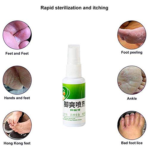 Foot Deodorant Spray, Zhengpin Herbal Formula Anti Fungal Remover, Foot Odor Sweat Eliminator Antibacterial Plant Bacteriostatic Herb Spray Foot Care (A)