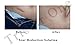 Tristar One Skin Care Titanium Microneedle 540 Micro Needles Derma Roller Needle-1.0mm