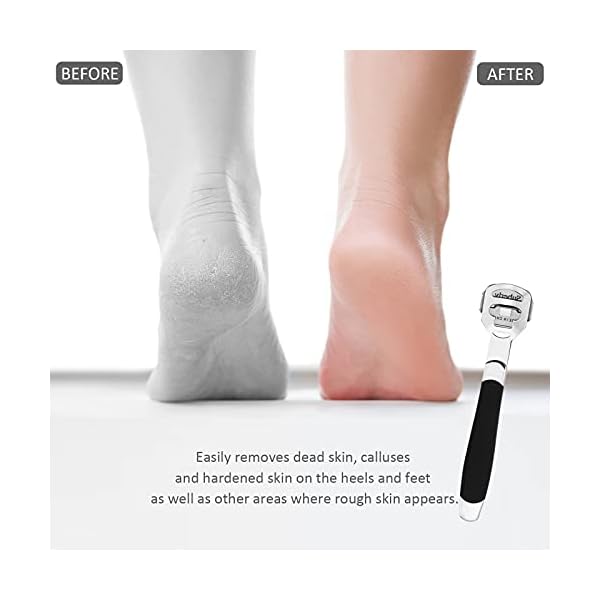 Foot-Scraper-Kit-Double-Sided-Foot-File-Hard-Skin-Callus-Remover-Feet-Care-Stainless-Steel-Pedicure-Tool-with-Case-Foot-File-Heads-10-Replacement-Blade-for-Dry-Callus-Dead-Cracked-Skin Foot Scraper Kit + Double-Sided Foot File, Hard Skin Callus Remover Feet Care, Stainless Steel Pedicure Tool with Case…