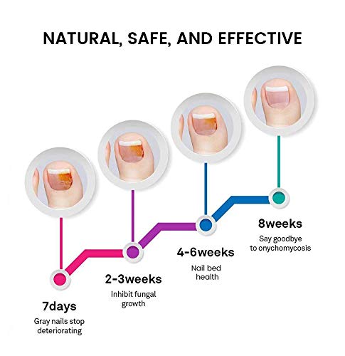 Toe Repair Fluid - Nail & Toenail Care Fungus Treatment - 2 Pcs - Thumbnail 3