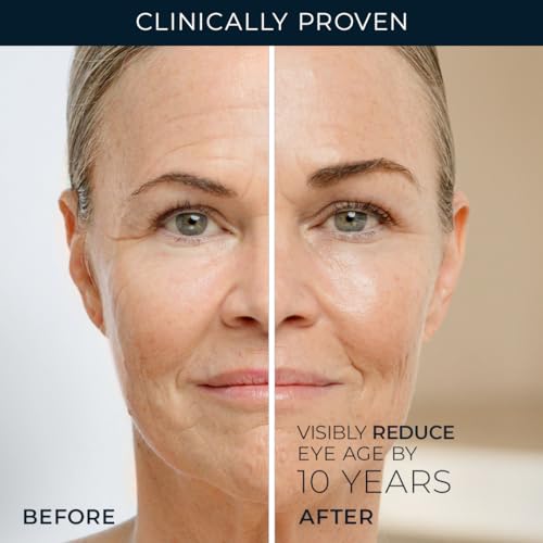 ROC RETINOL CORREXION UNDER EYE CREAM FOR DARK CIRCLES & PUFFINESS, DAILY WRINKLE CREAM, ANTI AGING SKIN CARE TREATMENT WOMEN AND MEN, 0.5 OZ (PACKAGING MAY VARY)