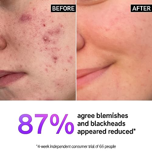 The INKEY List Salicylic Acid Cleanser, Face Wash For Acne, Blackheads