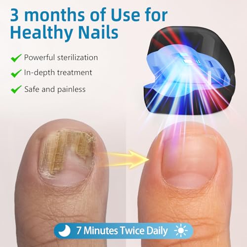Nail Fungus Laser Device Upgrade, Anti-Fungal for Damaged and Discoloured
