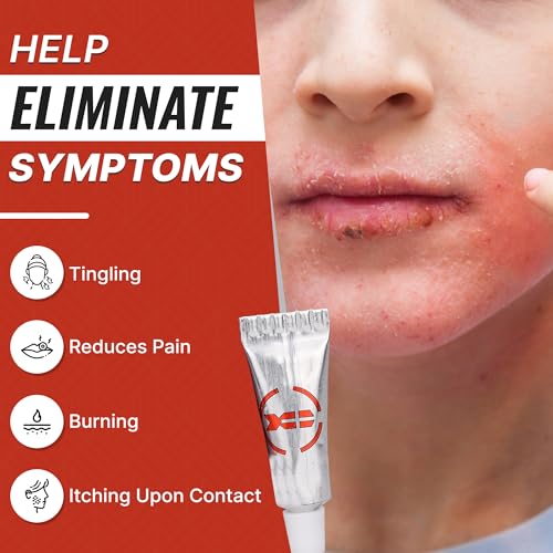 Cold Sore Treatment (Dragons Blood) - Made in USA - 1.7% Menthol - Relief - Quick Cold Sore Relief -