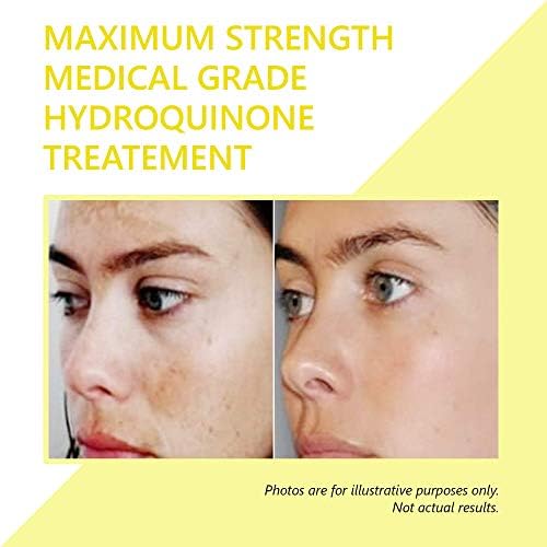 hydroquinone skin lightener & dark spot corrector