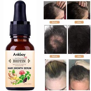 Hair-Growth-Serum-2020-Hair-Growth-Treatment-Hair-Serum-Anti-Hair-Loss-Thinning-Balding-Repairs-Hair-Follicles-Promotes-Thicker-Stronger-Hair-And-Promotes-Hair-Regrowth