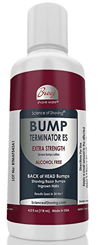 Bump Terminator Extra Strength ALCOHOL FREE Severe Bumps Lotion For Men (4 oz)