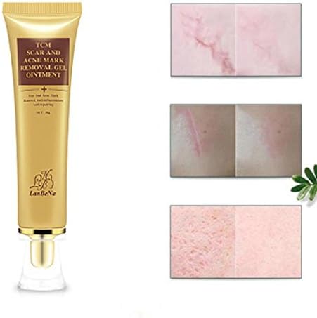 Peanutcool Scar Gel Scar Treatment, Acne Scar Removal Cream,Scar Fade Cream for Face and Body Treat New and Old Scars Acne Scars 30ml (Yellow)